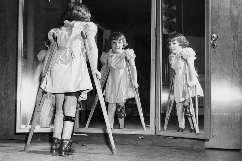 vaccines protect children against disease Child afflicted with polio, vintage image, Source: Iowa Public Radio vaccines protect children against disease